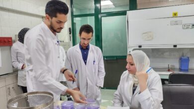 صورة “الزراعة” تكشف عن الاجراءات الوقائية  لمكافحة العفن البني في البطاطس