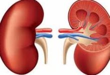 صورة انجاز لاول مرة.. رئيس الهيئةالعامة للمستشفيات والمعاهد الجامعية:  إجراء ١٦ حالة زرع كلى