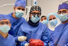 صورة نجاح عملية دقيقة ونادرة لاستئصال ورم ضخم يزن 6 كجم من جدار الصدر بمستشفى السلام التابعة لهيئة الرعاية الصحية بمحافظة بورسعيد