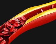 صورة الدكتورة أميرة عبدالهادي تكتب : ماهو الكوليسترول